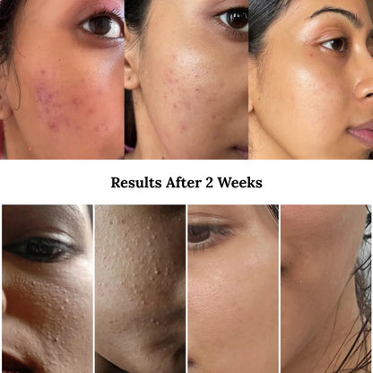 Dr. Althea - 345 Relief Cream™ Moisturizer